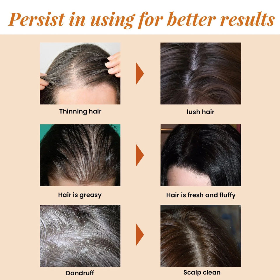 Horse Oil Nourishing Shampoo For Hair Loss