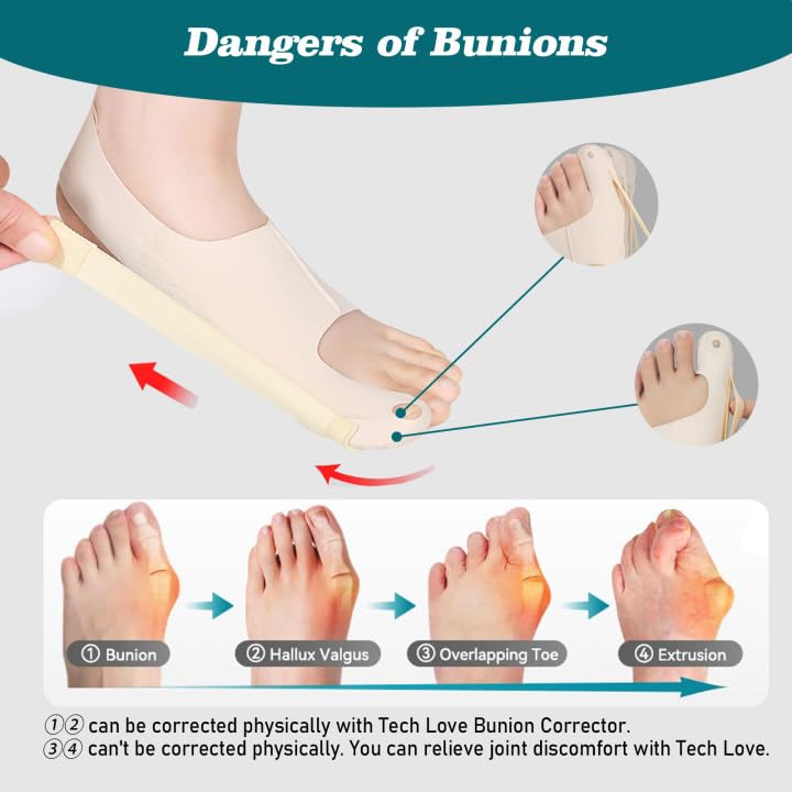 New Adjustable Toe Thumb Corrector