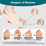 New Adjustable Toe Thumb Corrector