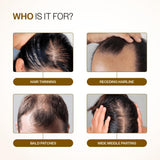 Advanced Hair Growth Roll-On Serum