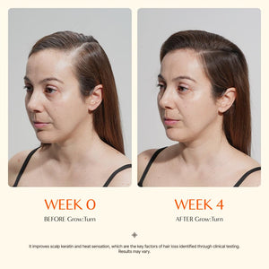 Growturn Ampoule Shampoo Set for Hair Growth and Thinning Hair