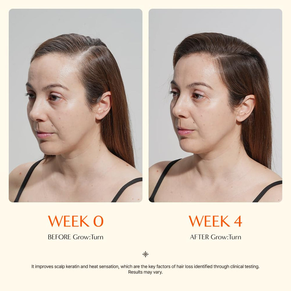 Growturn Ampoule Shampoo Set for Hair Growth and Thinning Hair