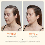 Growturn Ampoule Shampoo Set for Hair Growth and Thinning Hair