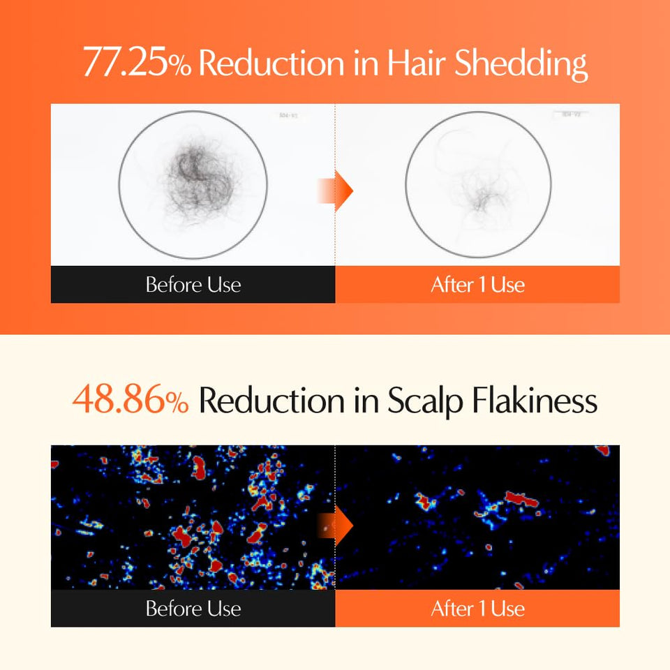 Growturn Ampoule Shampoo Set for Hair Growth and Thinning Hair