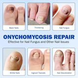 Night time Renewal Fungal Nail Patches
