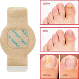 Night time Renewal Fungal Nail Patches