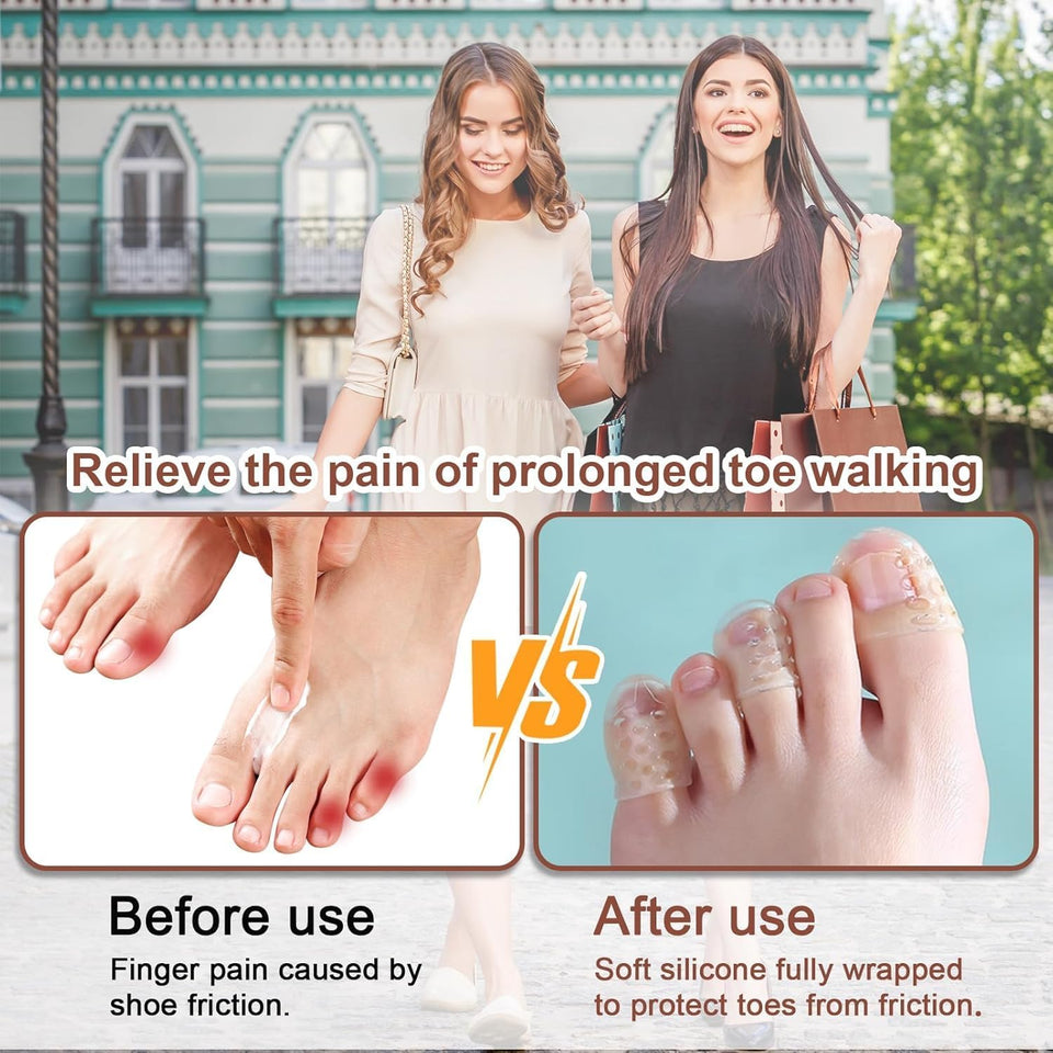 silicone Finger And Toe Protectors