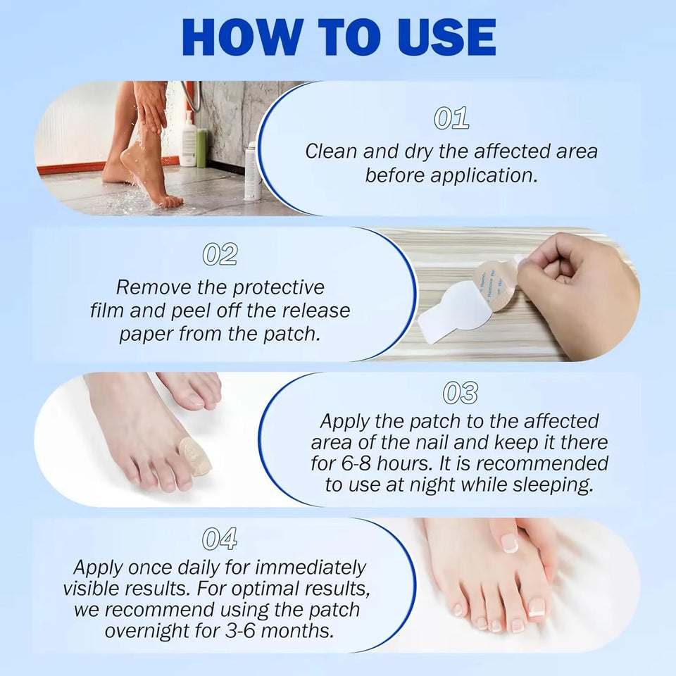 Night time Renewal Fungal Nail Patches