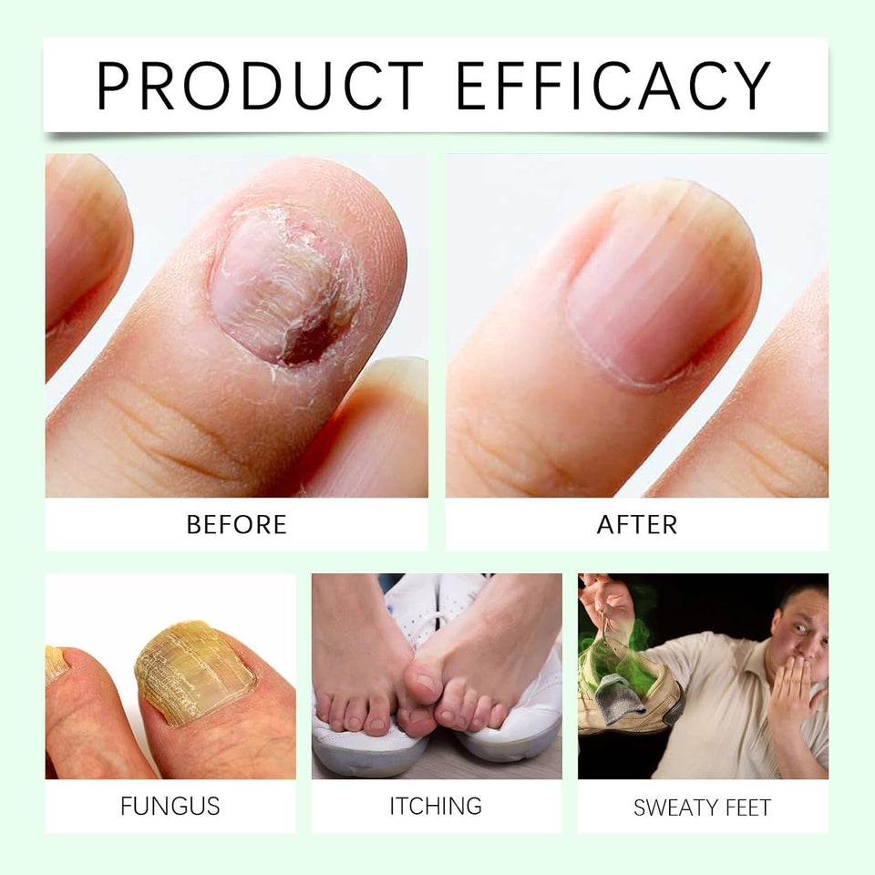 7 Days Ginger Nail Growth Serum & Cuticle Care Treatment