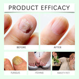 7 Days Ginger Nail Growth Serum & Cuticle Care Treatment