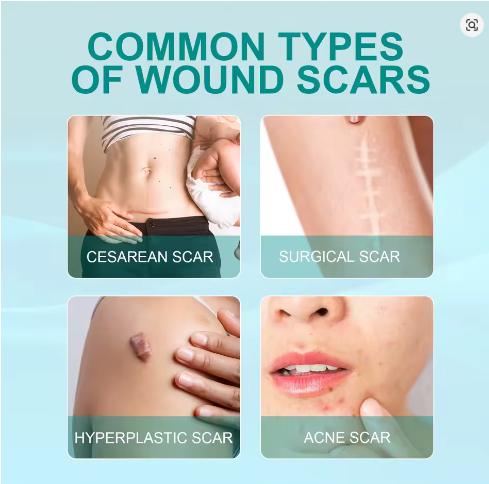 Body Scar Correcting Spray