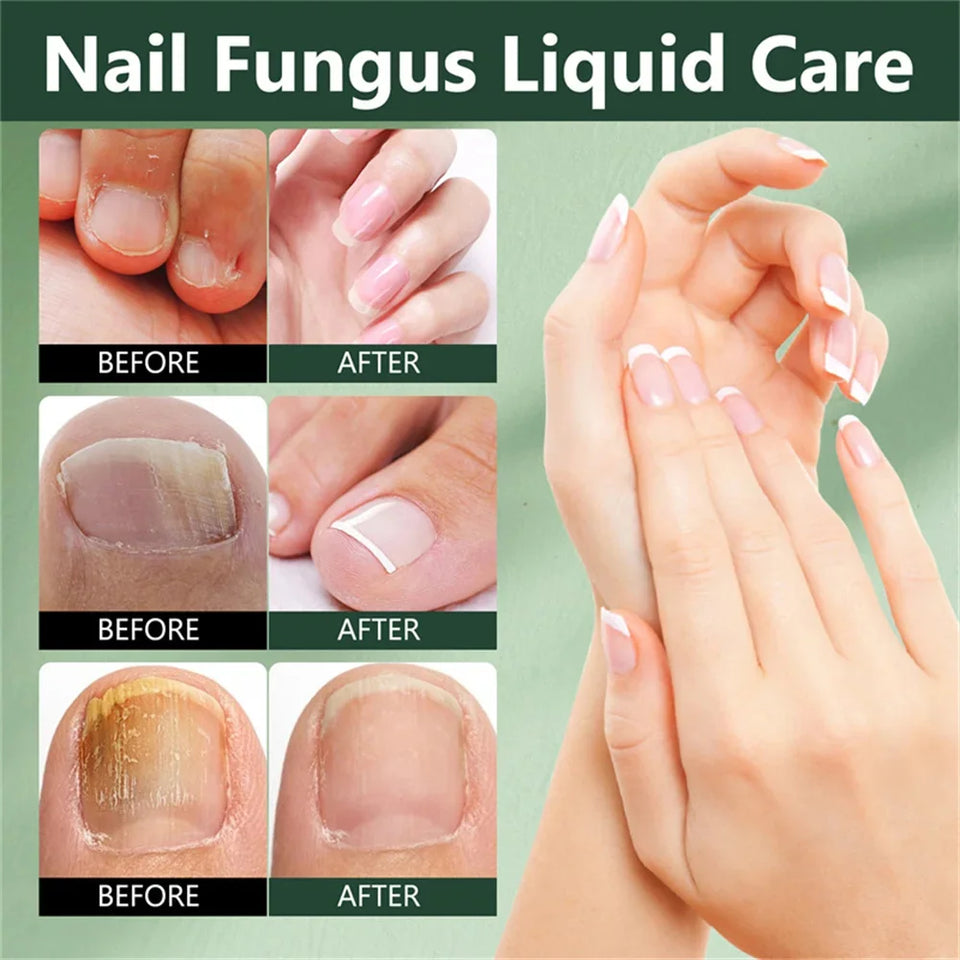 7 Days Ginger Nail Growth Serum & Cuticle Care Treatment