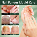 7 Days Ginger Nail Growth Serum & Cuticle Care Treatment