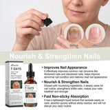 7 Days Ginger Nail Growth Serum & Cuticle Care Treatment