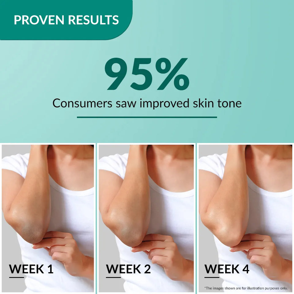 Nigrifix Cream A patented solution to treat hyperpigmentation